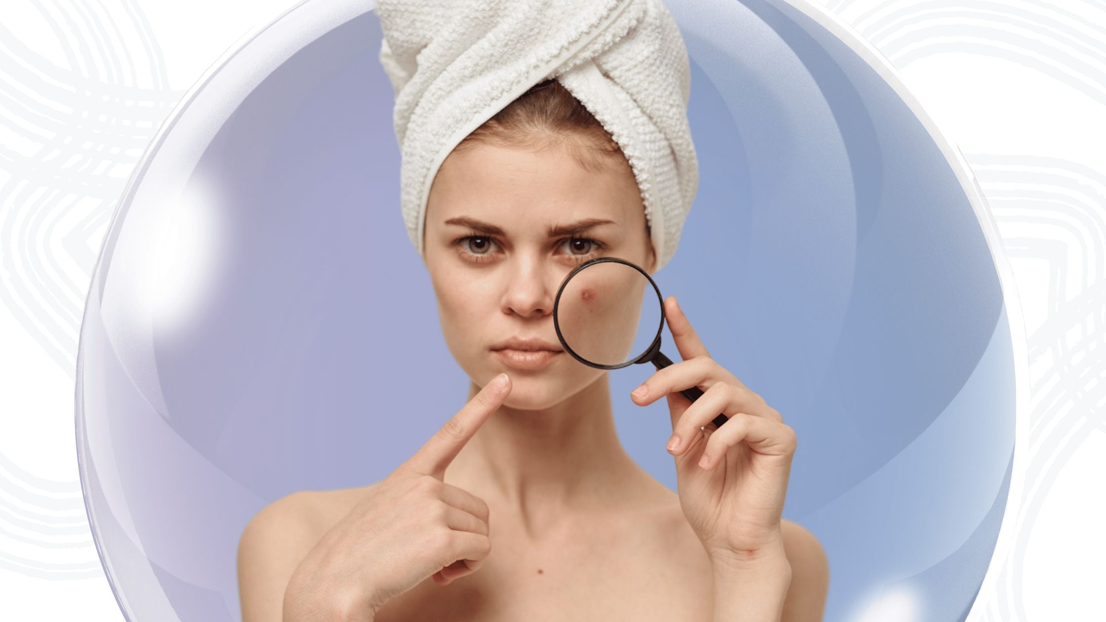 Hormonal Acne vs Regular Acne: Do Supplements Work Differently?